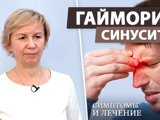 Гайморит: симптомы, причины, диагностика и лечение | Блог ЛДЦ Здоровье