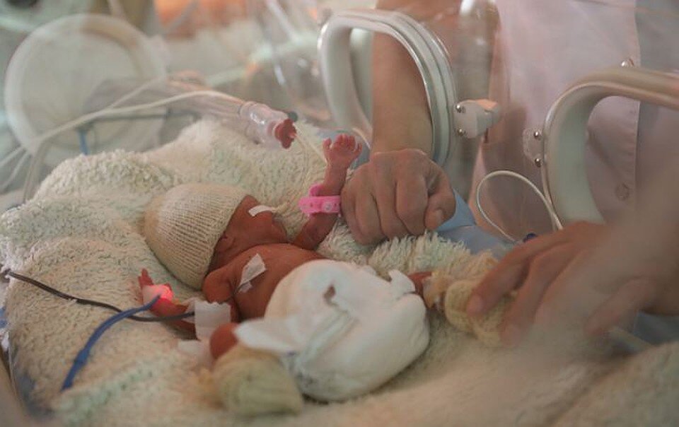 недоношенный ребенок