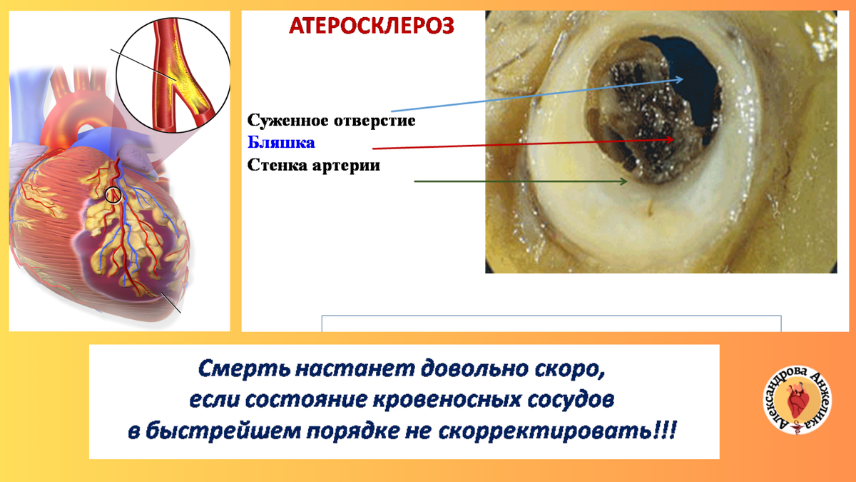 Как искоренить сердечные болезни, или азбука здоровья сердца | Надежда для  сердца | Дзен