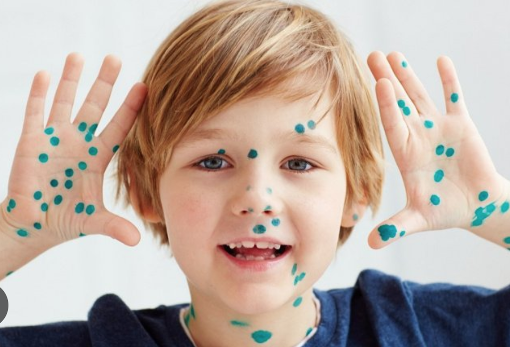 Источник фото: cidmedica.ru