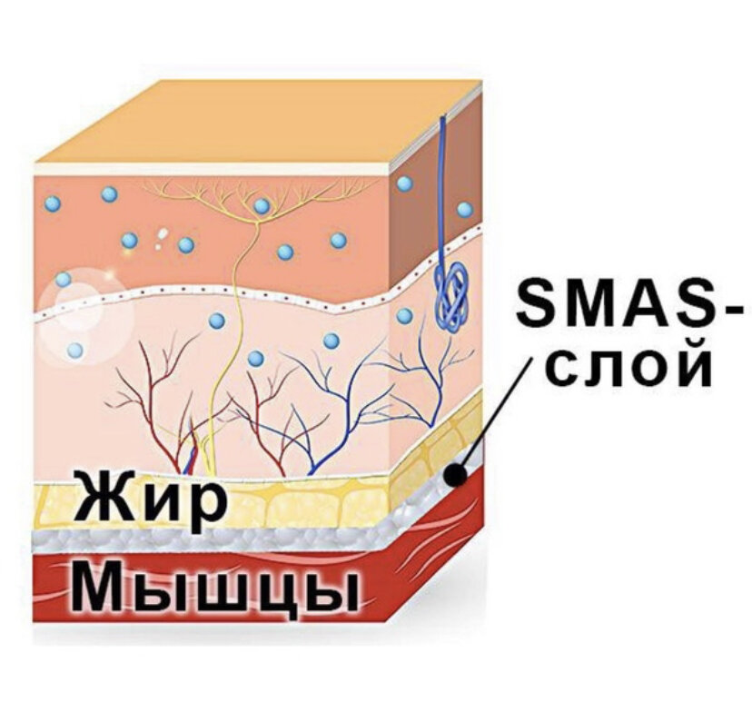 Схематично расположение SMAS