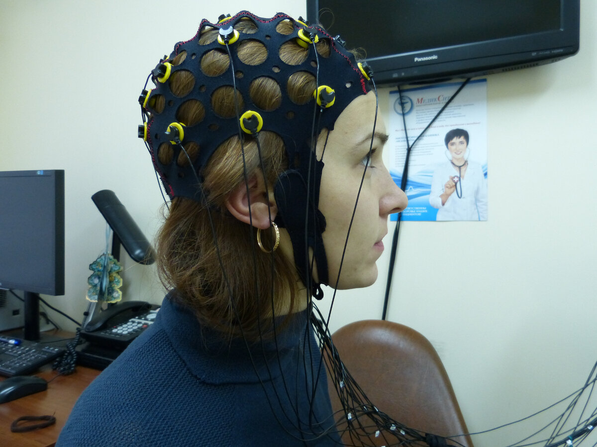 Электроэнцефалография (ЭЭГ). Может проводиться в первые часы после инсульта