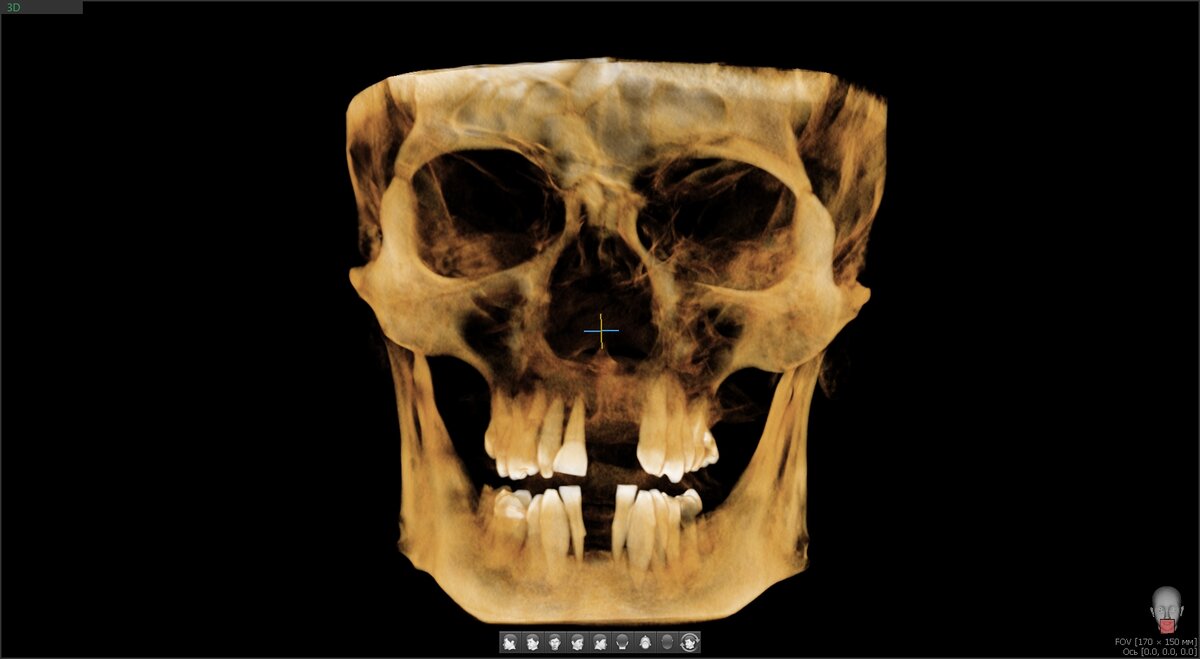 Ситуация до.