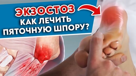 Психосоматика - настоящая болезнь или «выдуманное» расстройство? - Максим Степаньков