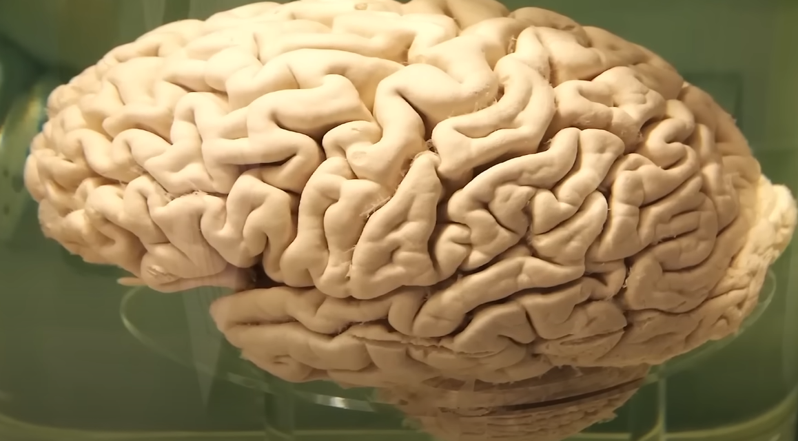 Мозг человека