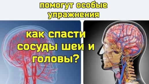 Почему жизнь мозга зависит от шеи? Полезные упражнения для сосудов шеи и мозга