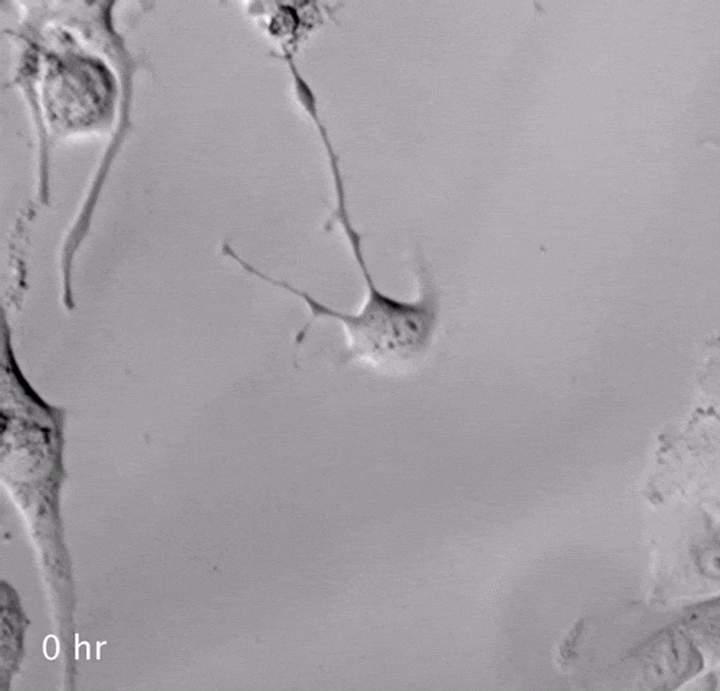 Движение нейронов. ASTARmicroscopy / YouTube 