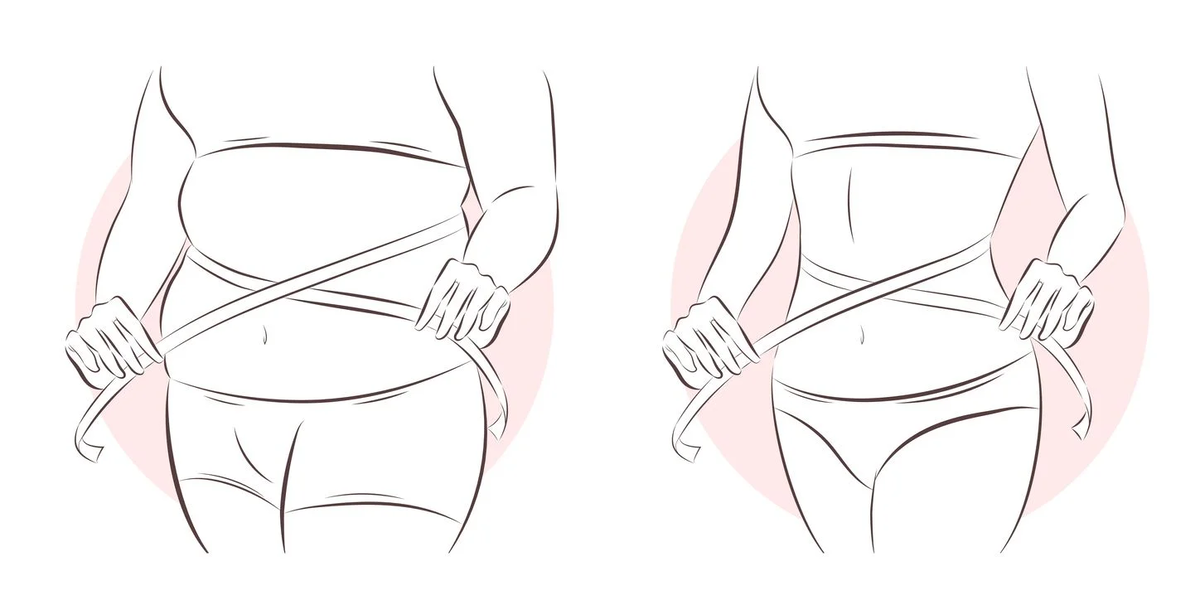 Эта операция позволяет укрепить мышцы передней брюшной стенки и удалить избытки кожи, что делает ваш живот плоским и подтянутым.