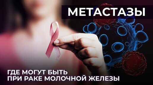 Метастазы | Куда метастазирует рак молочной железы? | Органы мишени при разных видах рака груди