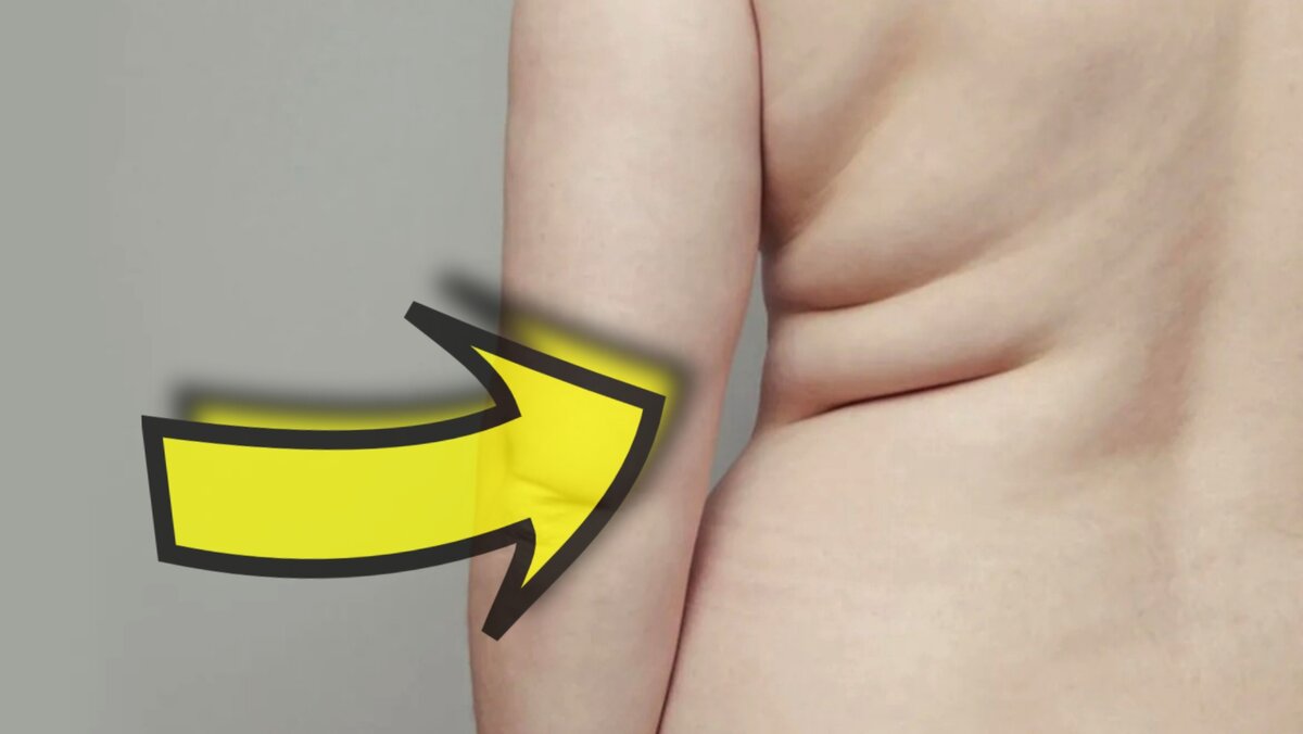 Даже стройную фигурку может испортить это безобразие