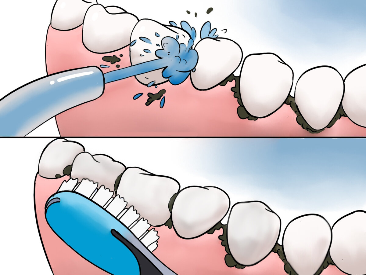 чистить зубы после минета фото 70
