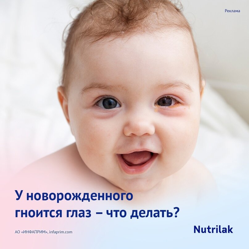 Гноится глаз у новорожденного. Что делать? | Nutrilak