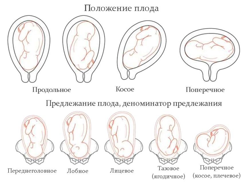 32 недели схватки