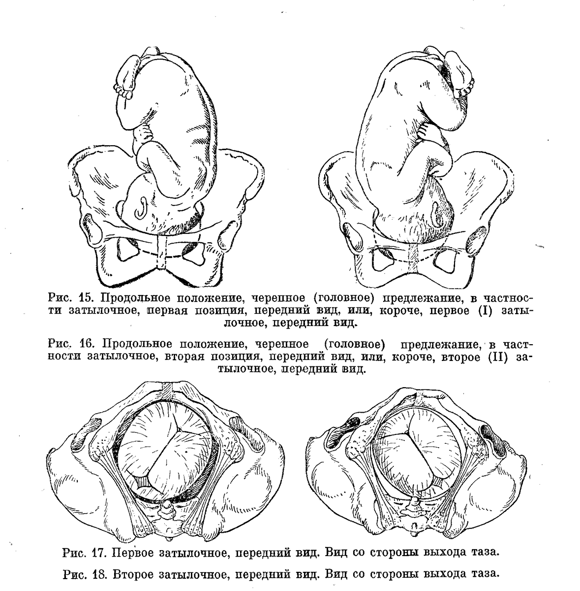 Запущенное положение плода. Неправильное положение плода. Продольное предлежит тазовый конец. Продольное головное 1 позиция передний вид. Продольное головное предлежание 2 позиция.