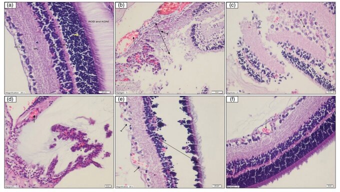 Гистопатологический вид ткани сетчатки в исследуемых группах. (а) Сетчатка группы NC. GCL: слой ганглиозных клеток, IPL: внутренний плексиформный слой, INL: внутренний ядерный слой, OPT: внешний плексиформный слой, ONL: внешний ядерный слой, ROD и KONI (H&E 400) (б) Расширенные и перегруженные кровеносные сосуды в GCL поврежденной сетчатки (плоские стрелки), деструкция по всем остальным слоям (двойная стрелка) и ПМНЛ (полосатая стрелка) наблюдались в сетчатке крыс группы DC (H&E 200) (в) Тяжелый ГКЛ повреждение сетчатки крыс группы DC (H&E 400) (г) Формирование расширенных и перегруженных кровеносных сосудов (плоская стрелка) и папиллярных структур (круглая стрелка) в ГКЛ в сетчатке крыс группы DC (H&E 400) (д) Отек (полосатая стрелка), расширенный и застойный (плоская стрелка), полнослойная деструкция с участием наружного и INL в сетчатке GCL в сетчатке крыс группы DC (H&E 400) (f) Почти нормальный внешний вид GCL в ткани сетчатки группы TAX, за исключением продолжающихся расширенных и перегруженных кровеносных сосудов (H&E 400)