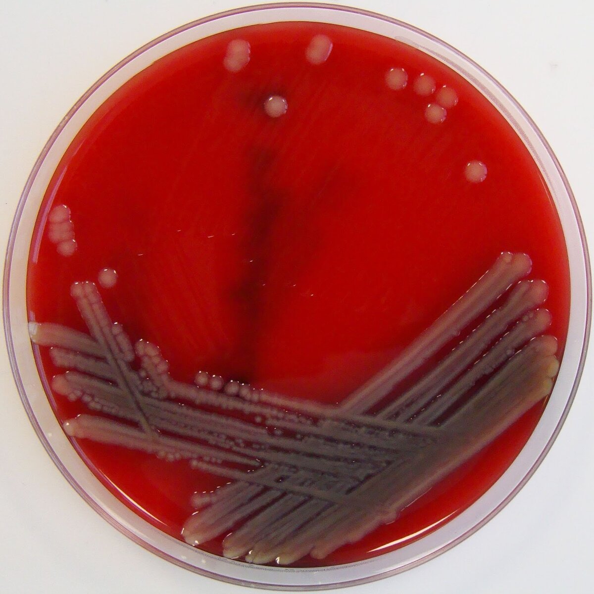 Aeromonas hydrophila (Аэромонас Хайдрофила)
