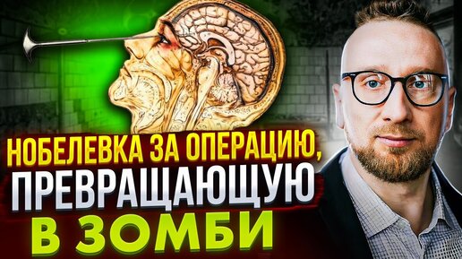 Лоботомия – величайшая медицинская ошибка