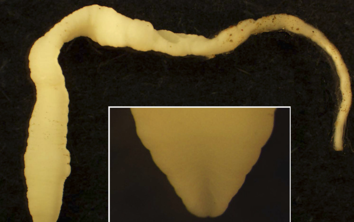 спарганоз возбудитель. спарганум пролиферум. эстетика infected. спарганум пролиферум.