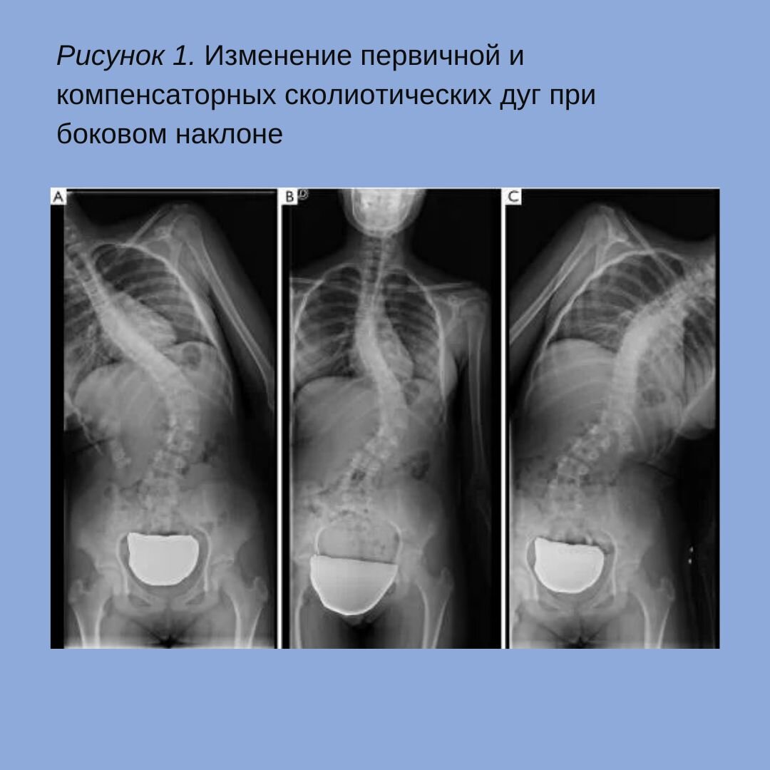 Рисунок 1