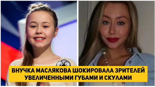 Внучка Маслякова шокировала зрителей увеличенными губами и скулами ...