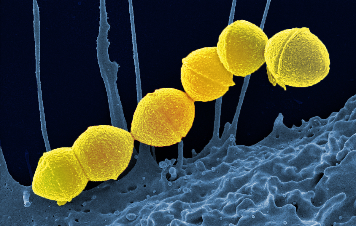Streptococcus pyogenes. Иллюстрация: wikipedia.org