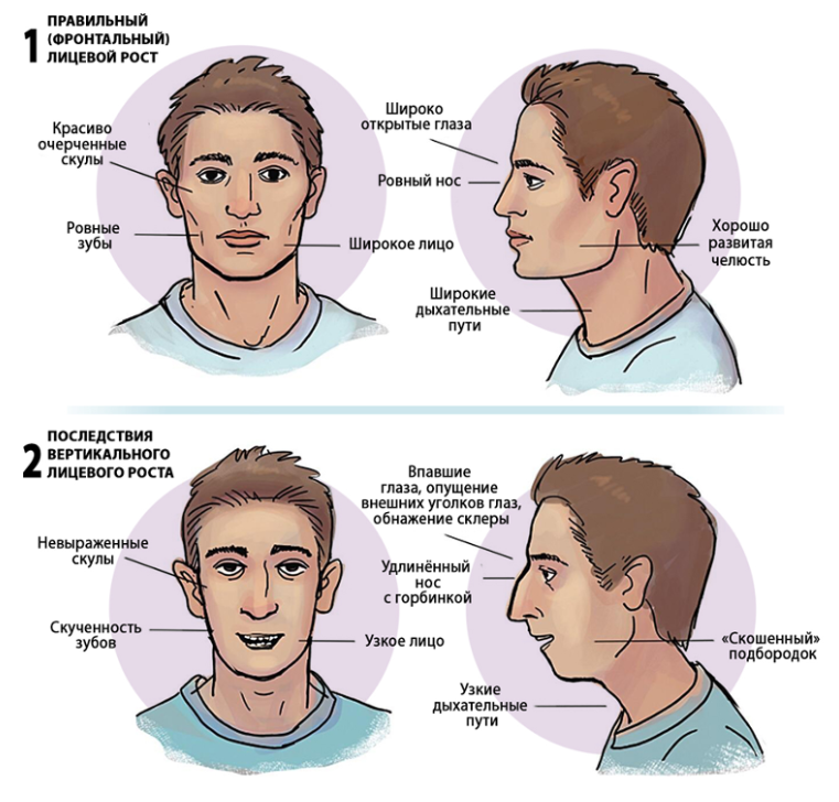 Почему нельзя подбородок. Дыхание носом. Изменение подбородка.