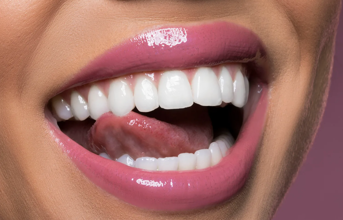 Стриппинг, сепарация – вредно ли «подпиливание» зубов?