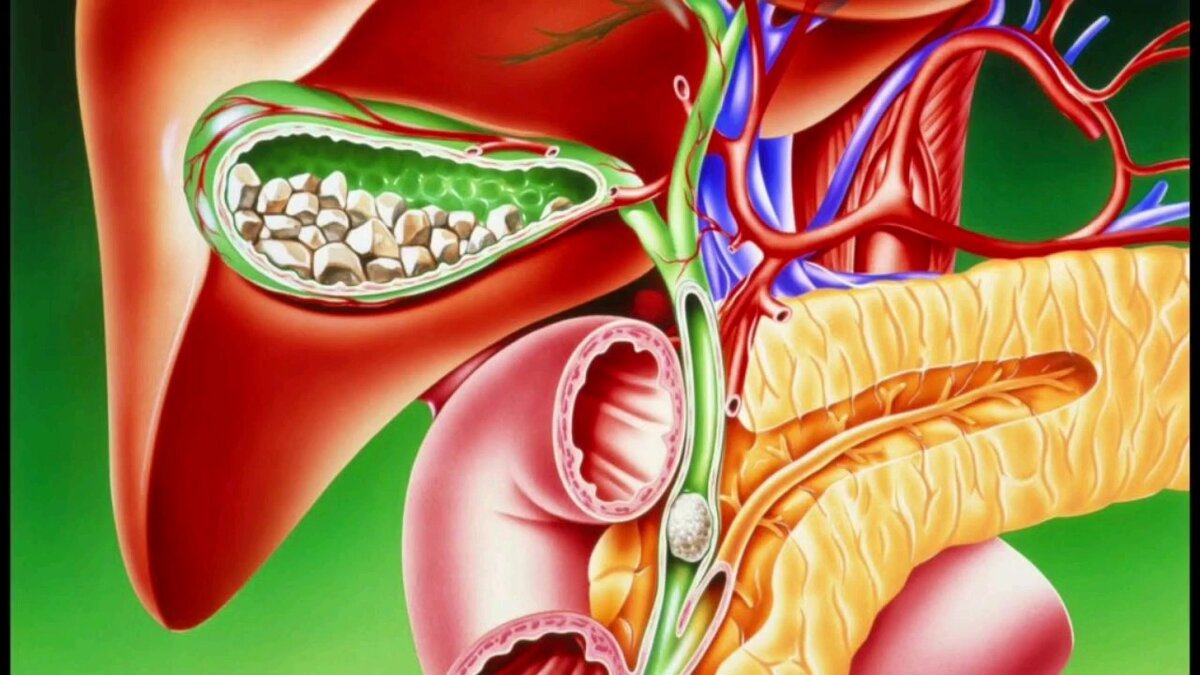 Источник фото: https://www.youtube.com/watch?v=7FprOHkeYwU