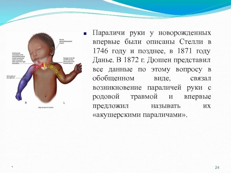 Информация из интернета 