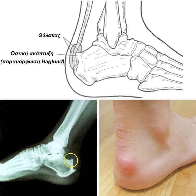 Image Radiopaedia.org