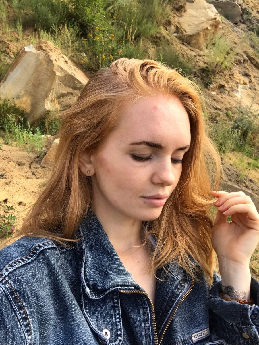 Здесь моя кожа уже прошла острый период, но не все равно это не идеально чистая кожа