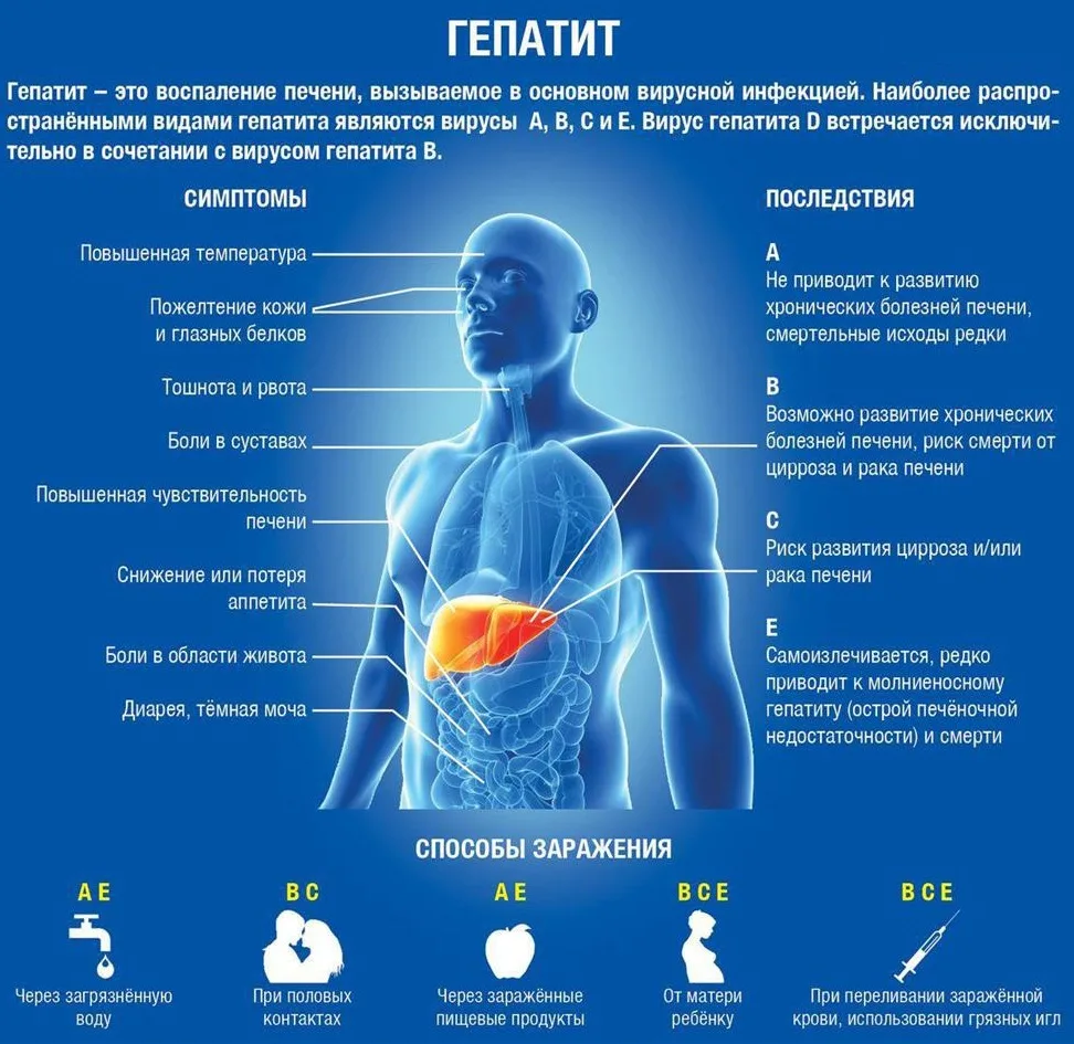 Болит ли печень? Как себя проявляет гепатит – воспаление печени | О  здоровье: с медицинского на русский | Дзен