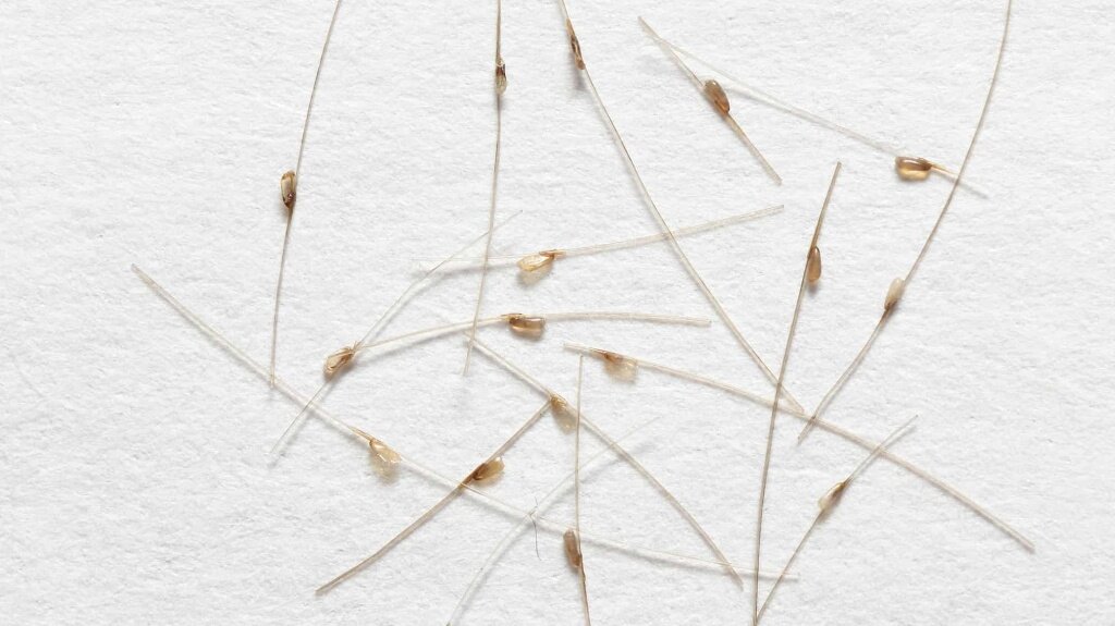 Так выглядят гниды, которые нужно вычесывать.