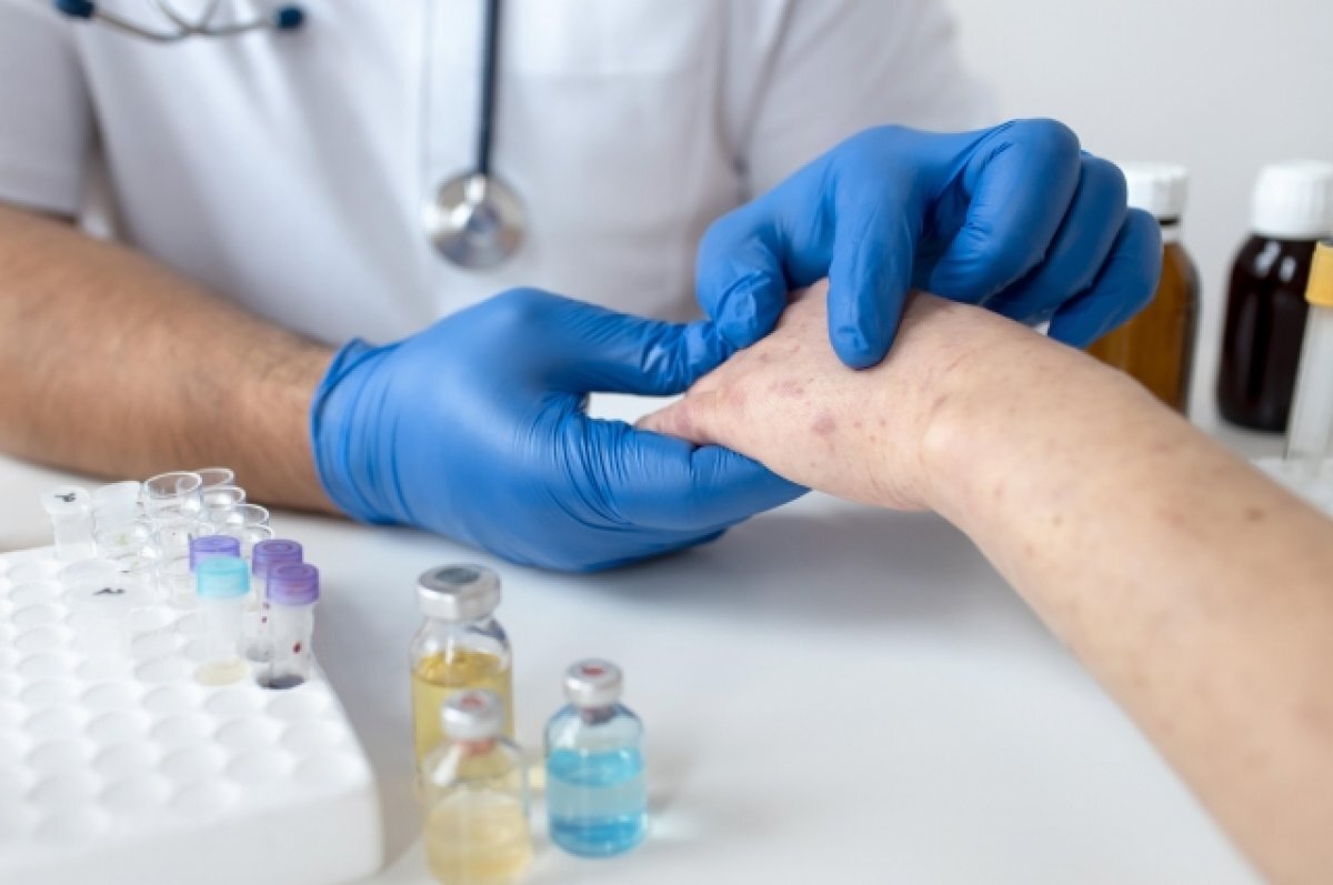    В причинах появления псориаза врачи до конца не разобрались.