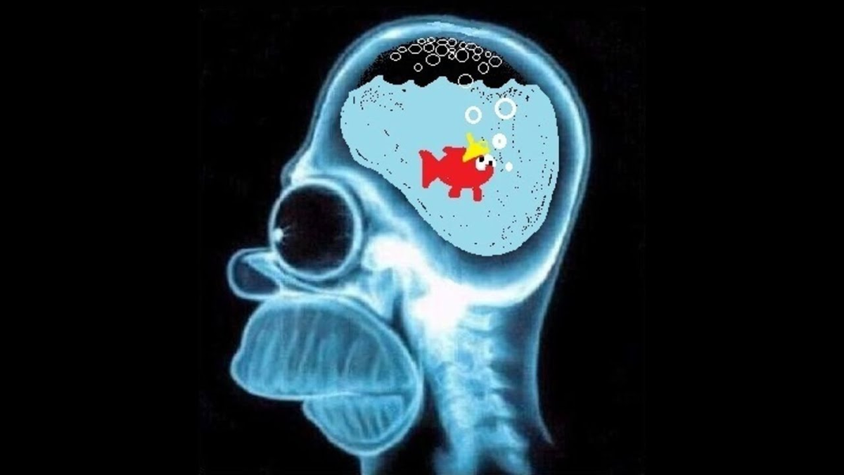 Рентген головы с маленьким мозгом. Рентгеновский снимок мозга. Головного мозга мем. Маленький мозг. Мозг в руках.