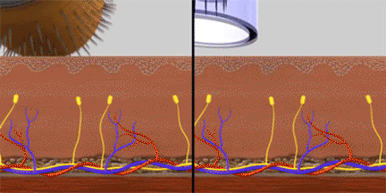 Дермароллеры из-за смены угла во время движения ощущаются болезненнее, чем дермаручки. 