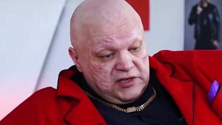 В этой ситуации он мог и не выжить.