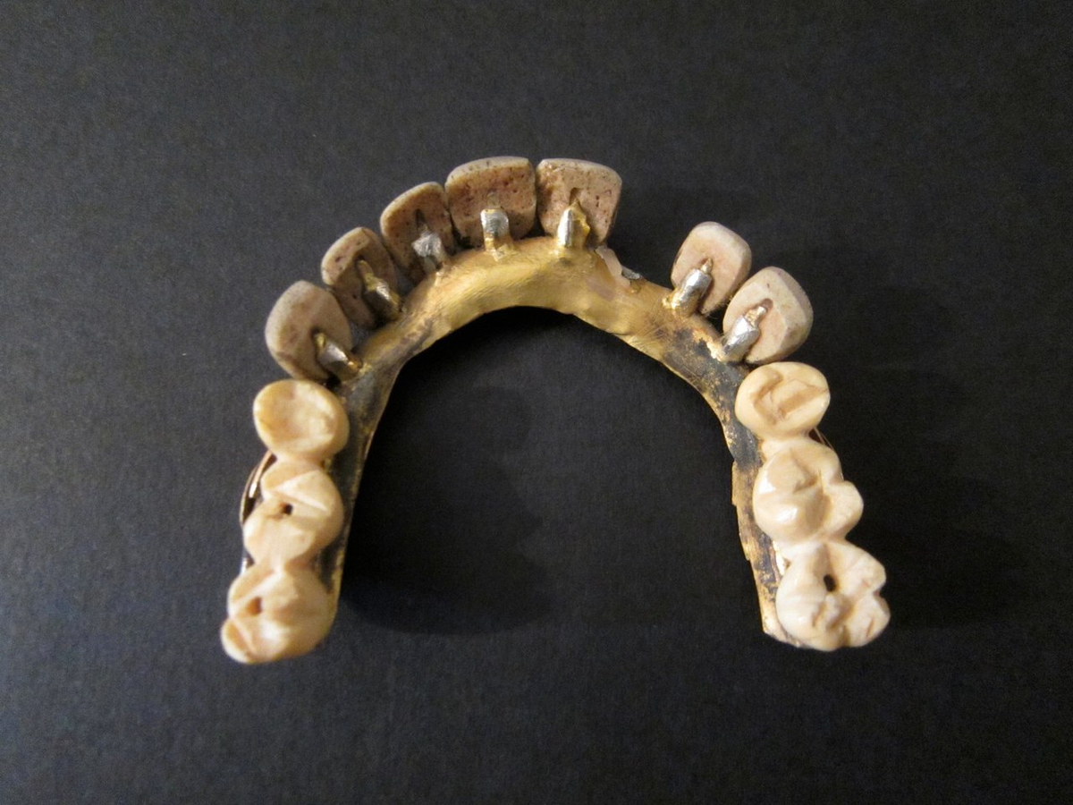 17 18 зуб. Зубные протезы в древнем Египте. Пьер Фошар зубные протезы.