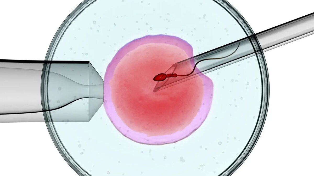 картинка яндекс