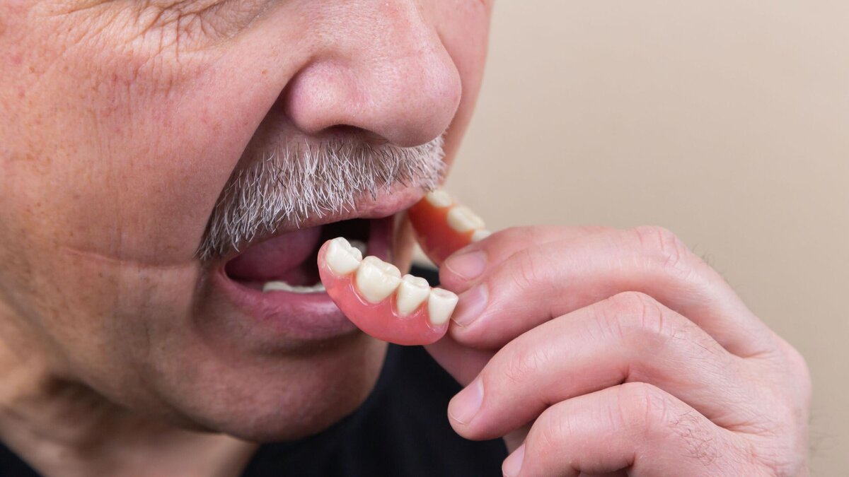    Протезирование зубов пенсионерам бесплатно: как в Москве получить льготу© Unsplash | Диана Полехина