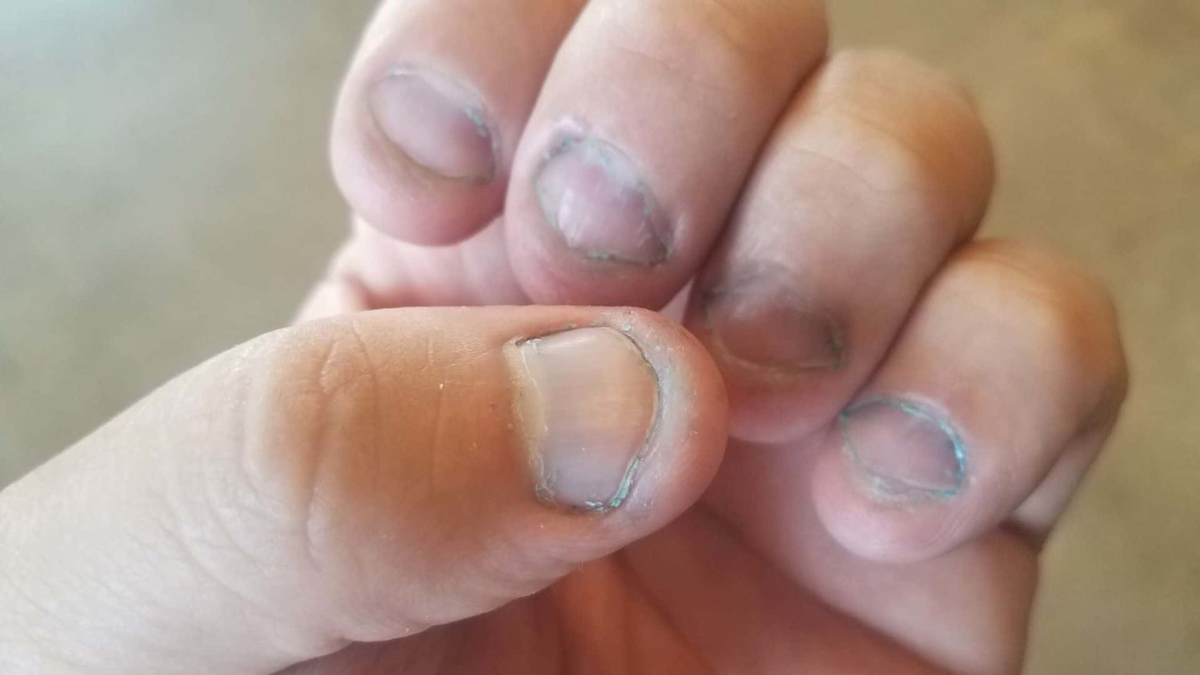 7 señales que te dan las uñas de las manos de que algo va mal en tu salud Uñas m