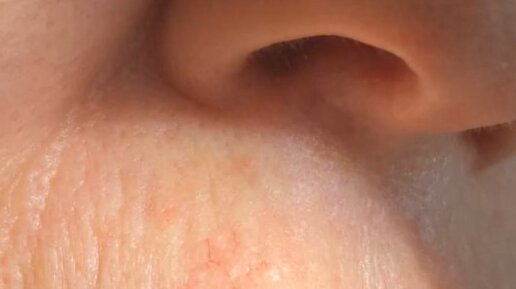 Доктор Роман Евстратов - хирург, онколог, онкодерматолог | Лечение ...