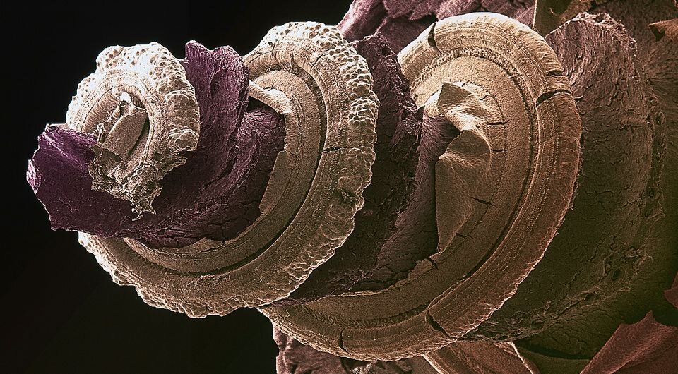   Dr. David Furness / Wellcome Collection