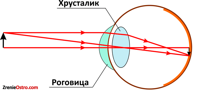 Оптическая система глаза дефекты зрения проект "Наше зрение" Школьные проекты