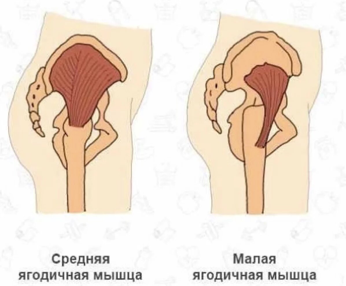 Ягодичные мышцы: их функции, работа, форма | POPOVICHFIT | Мир умного  фитнеса | Дзен