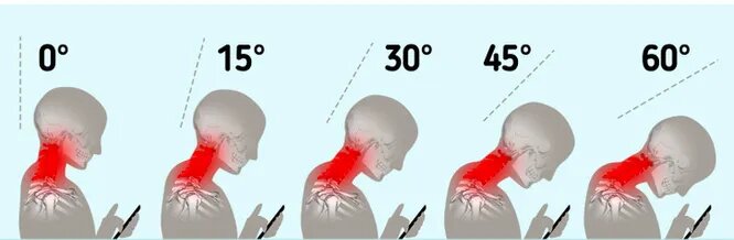 При наклоне головы на 30 градусов нагрузка на позвоночник увеличивается до 18 кг, если наклонить голову на 60 градусов, то нагрузка будет составлять около 27 кг. 