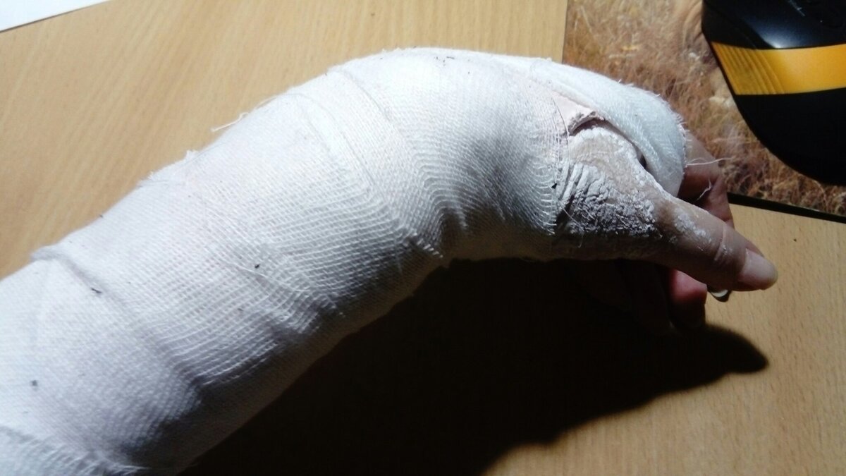 Вот она - "костяная рука" моя / фото автора