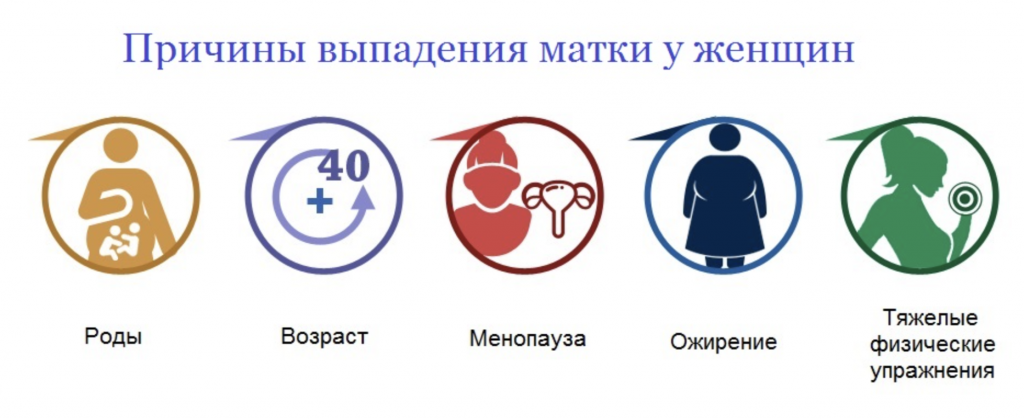 Опущение матки симптомы. Опущение и выпадение матки. Опущение и выпадение матки причины. Факторы выпадения матки. Симптомы опущения матки у женщин.
