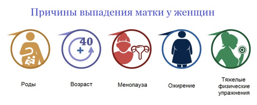 Признаки опущения органов малого таза у женщин. Опущение и выпадение матки. Опущение и выпадение матки причины. Факторы выпадения матки. Симптомы опущения матки у женщин.