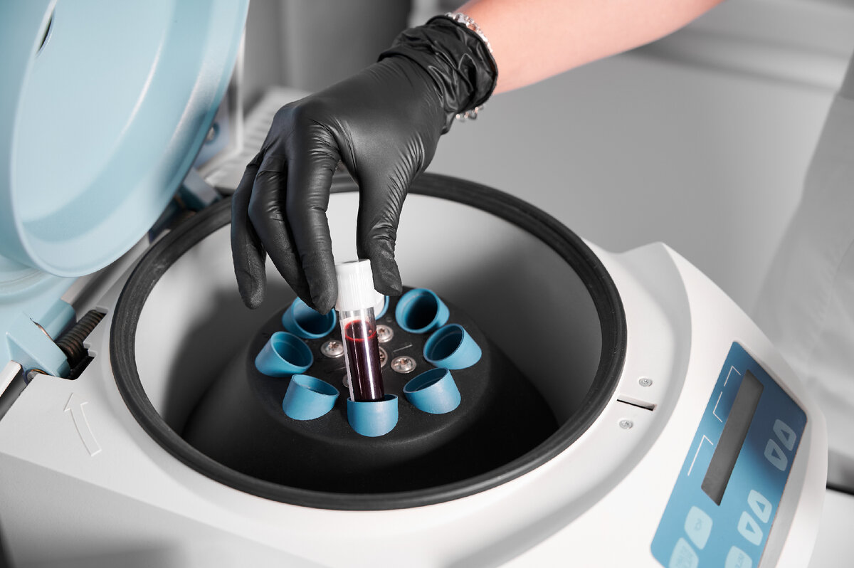 Источник <a href="https://ru.freepik.com/free-photo/preparation-of-blood-for-injections-cosmetologist-puts-tube-of-blood-in-centrifuge_27330399.htm#page=2&query=%D0%BB%D0%B0%D0%B1%D0%BE%D1%80%D0%B0%D1%82%D0%BE%D1%80%D0%B8%D1%8F&position=14&from_view=search&track=sph">Изображение от ArtPhoto_studio</a> на Freepik